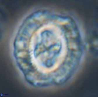 Cruciplacolithus tenuis 21710