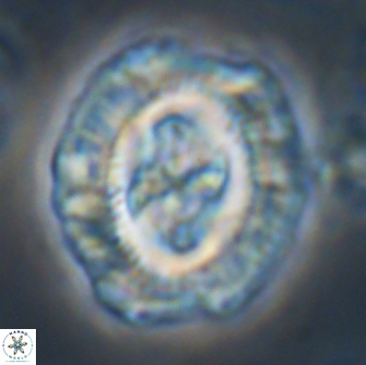 Cruciplacolithus tenuis 21710