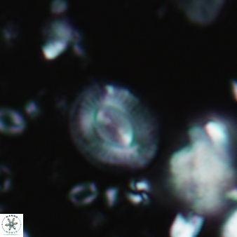 Cryptococcolithus mediaperforatus 379