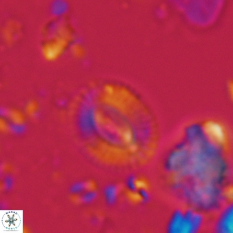 Cryptococcolithus mediaperforatus 380