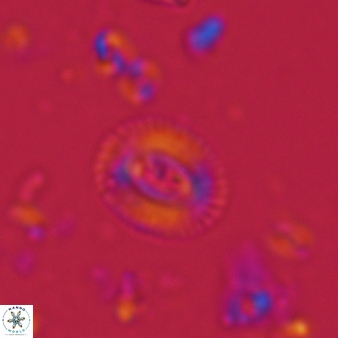Cryptococcolithus mediaperforatus 390