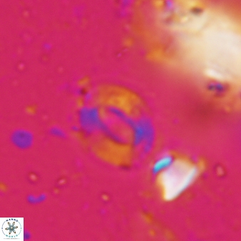 Cryptococcolithus mediaperforatus 641