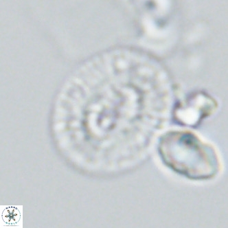 Cryptococcolithus mediaperforatus VR 09684