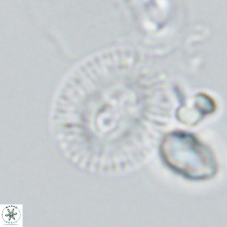 Cryptococcolithus mediaperforatus VR 09685