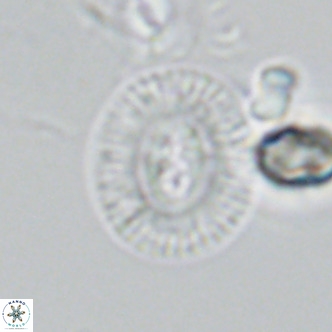 Cryptococcolithus mediaperforatus VR 09686