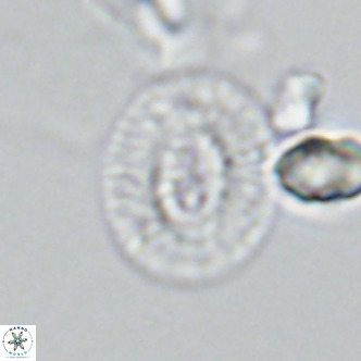 Cryptococcolithus mediaperforatus VR 09687