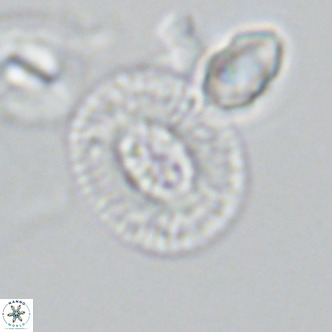 Cryptococcolithus mediaperforatus VR 09688