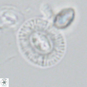 Cryptococcolithus mediaperforatus VR 09689