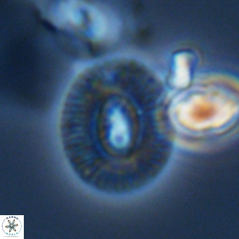 Cryptococcolithus mediaperforatus VR 09691