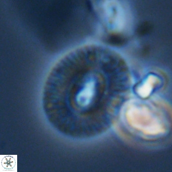 Cryptococcolithus mediaperforatus VR 09692