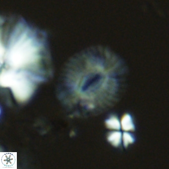 Cryptococcolithus mediaperforatus VR 09168