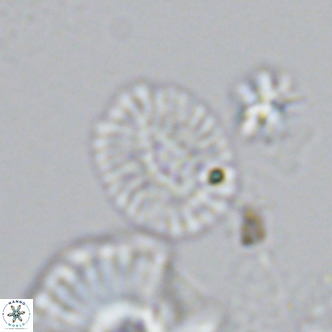 Cryptococcolithus mediaperforatus VR 09175