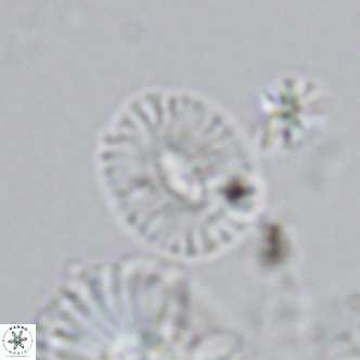 Cryptococcolithus mediaperforatus VR 09176