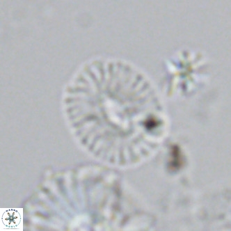 Cryptococcolithus mediaperforatus VR 09177