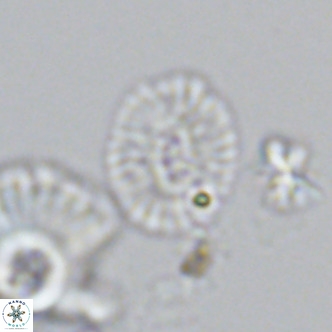 Cryptococcolithus mediaperforatus VR 09178