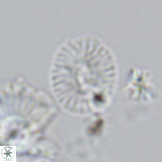 Cryptococcolithus mediaperforatus VR 09179