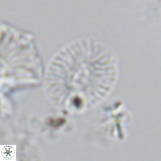 Cryptococcolithus mediaperforatus VR 09180