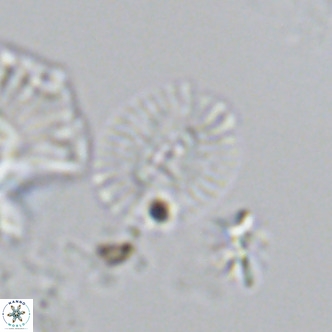 Cryptococcolithus mediaperforatus VR 09181