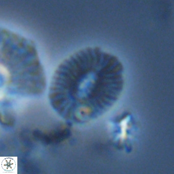 Cryptococcolithus mediaperforatus VR 09182