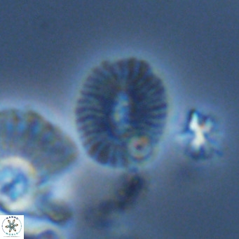 Cryptococcolithus mediaperforatus VR 09184