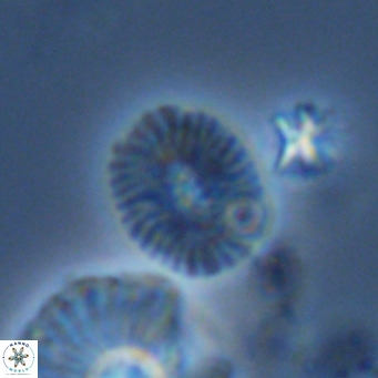Cryptococcolithus mediaperforatus VR 09185