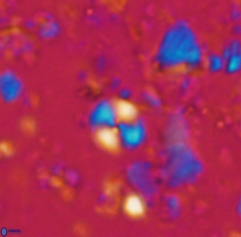 Cyclagelosphaera margerelii 1306