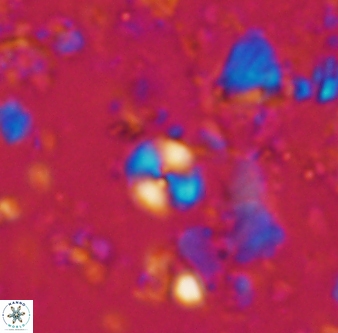Cyclagelosphaera margerelii 1306