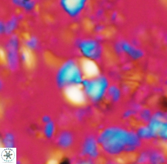 Cyclagelosphaera margerelii 1314