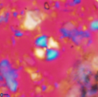 Cyclagelosphaera margerelii 1317