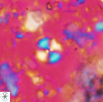 Cyclagelosphaera margerelii 1317