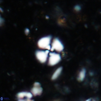 Cyclagelosphaera margerelii 1577