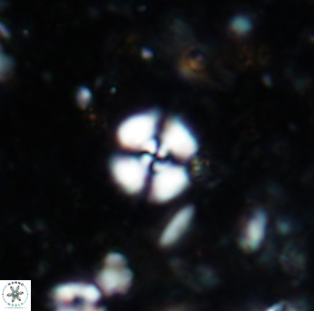 Cyclagelosphaera margerelii 1577