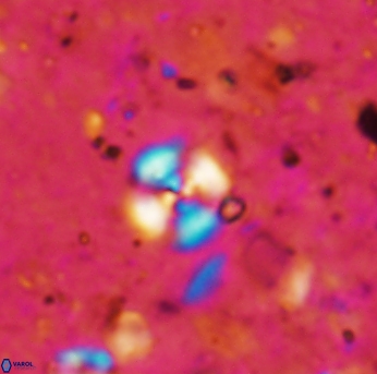 Cyclagelosphaera margerelii 1578