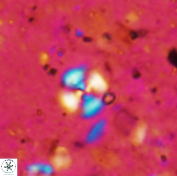 Cyclagelosphaera margerelii 1578