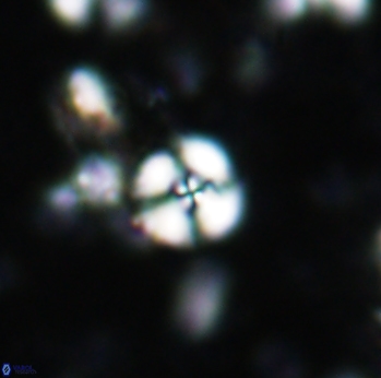 Cyclagelosphaera margerelii 1608
