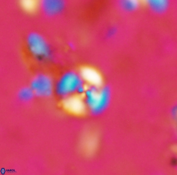 Cyclagelosphaera margerelii 1609