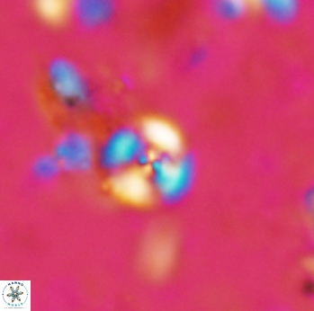 Cyclagelosphaera margerelii 1609
