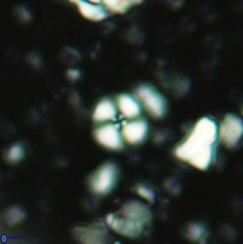 Cyclagelosphaera margerelii 2064