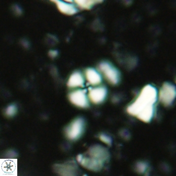 Cyclagelosphaera margerelii 2064