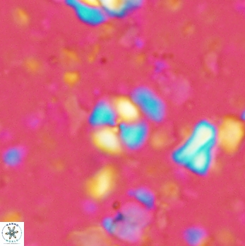 Cyclagelosphaera margerelii 2065