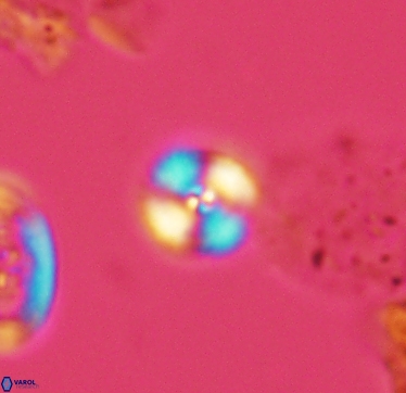 Cyclagelosphaera margerelii 2951