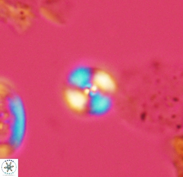 Cyclagelosphaera margerelii 2951