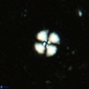Cyclagelosphaera margerellii VR 12905