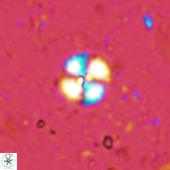 Cyclagelosphaera margerellii VR 12906