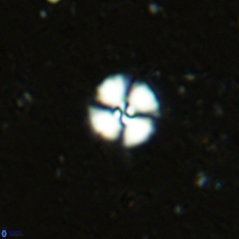 Cyclagelosphaera margerellii VR 12907