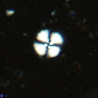 Cyclagelosphaera margerellii VR 12909
