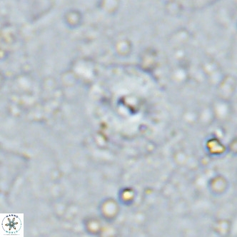 Cyclagelosphaera margerellii VR 12914