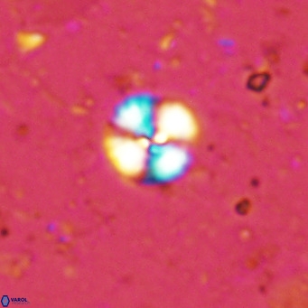 Cyclagelosphaera margerellii VR 12910