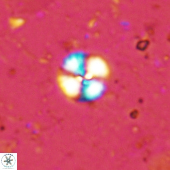 Cyclagelosphaera margerellii VR 12910