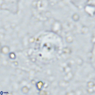 Cyclagelosphaera margerellii VR 12911